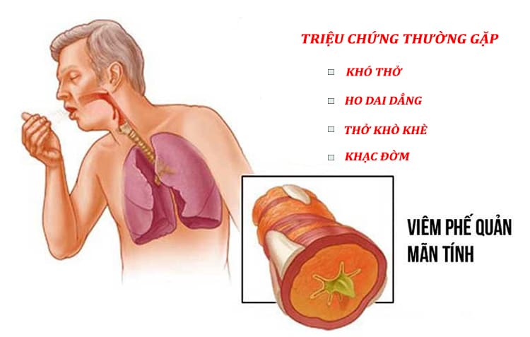 trieu-chung-viem-phe-quan-man-tinh