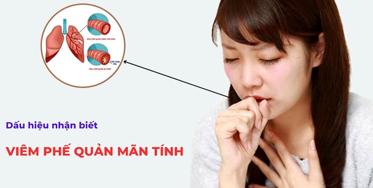 Chi Tiết Bệnh Lý Về Bệnh Viêm Phế Quản Mãn Tính