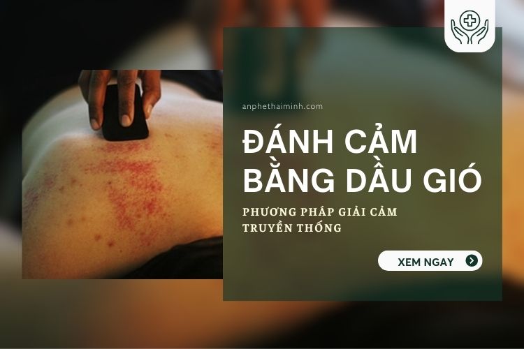 Đánh cảm bằng dầu gió: Phương pháp giải cảm truyền thống